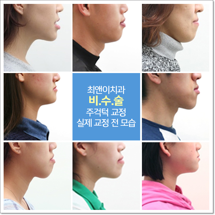 치아턱교정 달라짐이 보이려면 관련 이미지 3