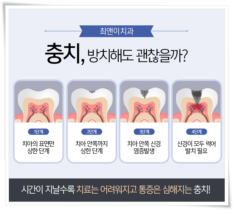명동치과 아프지 않도록 하려면 관련 이미지 10