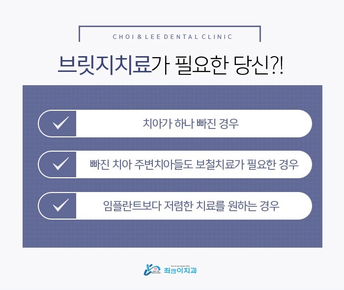 앞니브릿지가격 부담이 없어야 관련 이미지 6