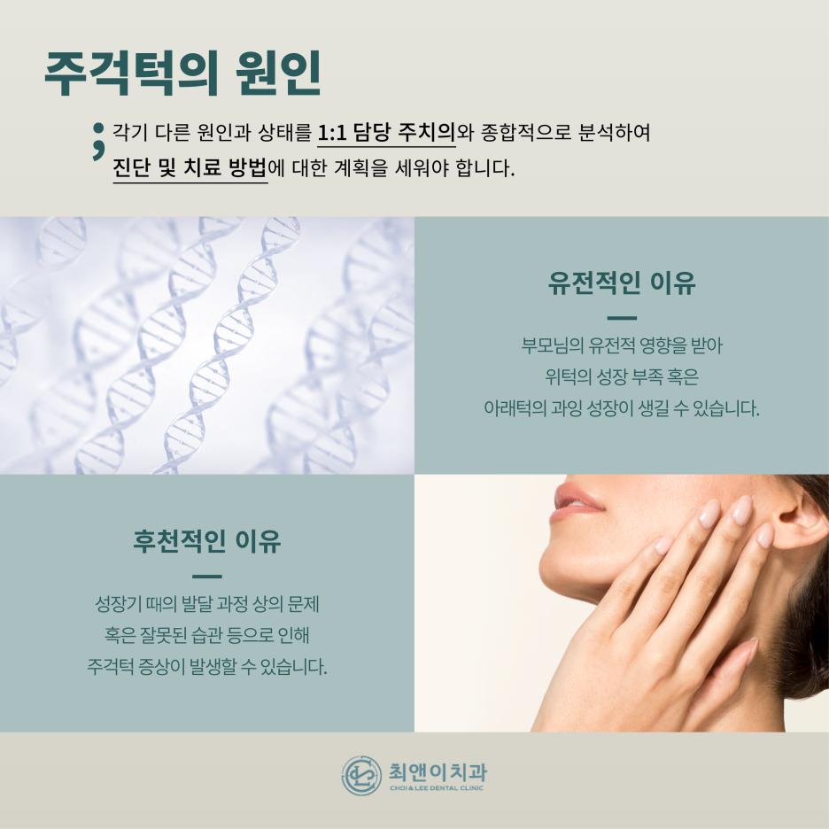 주걱턱의 정의와 증상에 대해 관련 이미지 4