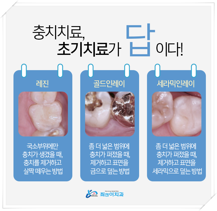 앞이빨 깨짐 허전함이 느껴지면 관련 이미지 7