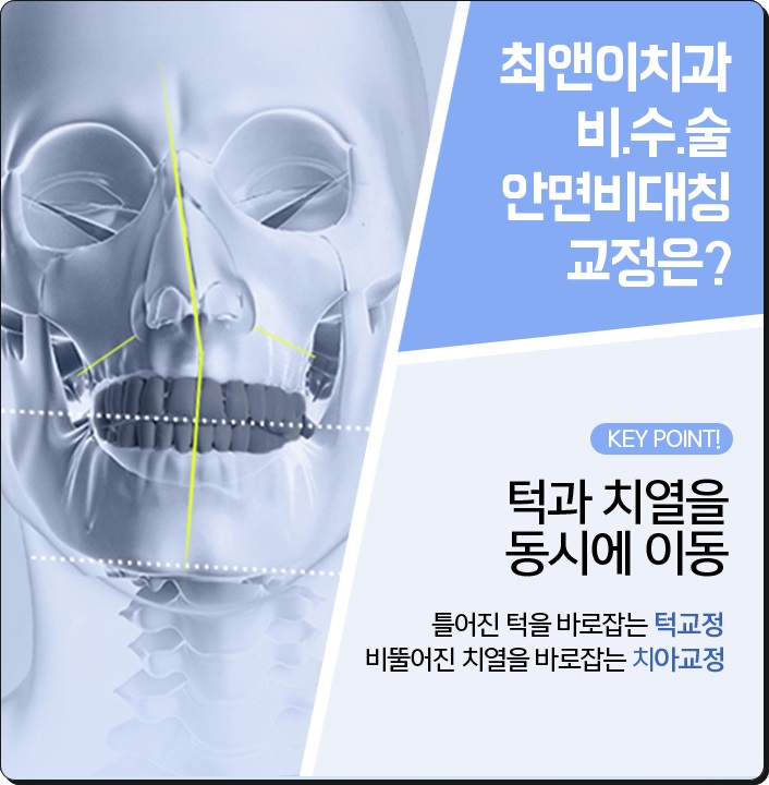 안면비대칭교정비용 밸런스가 잡히게 관련 이미지 6