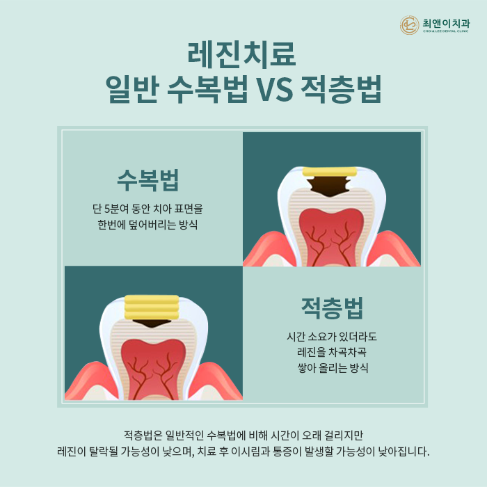 자연치아를 보존하기 위한 충치치료 방법 관련 이미지 6
