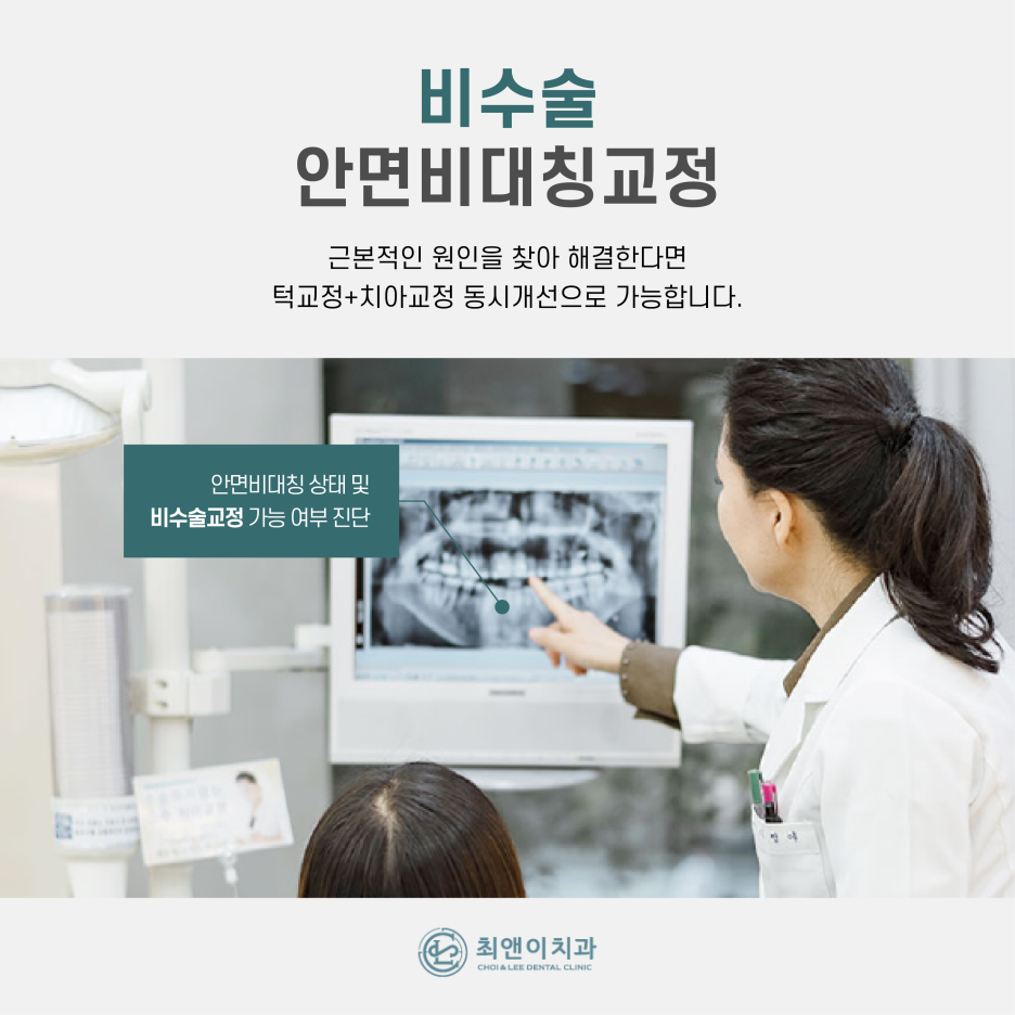 안면비대칭 증상과 원인에 대해 관련 이미지 5