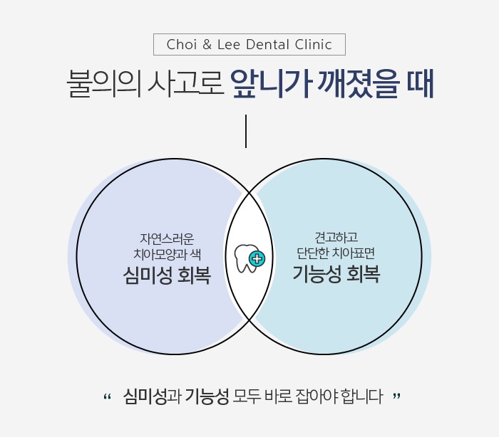앞니브릿지잘하는곳 상황에 적합하도록 관련 이미지 4