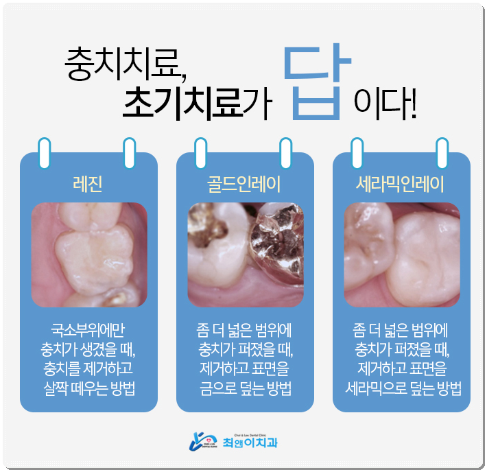 종각역치과 찾아보시면 관련 이미지 8