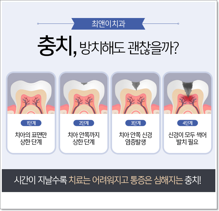 종각치과 무엇이 다를까? 관련 이미지 7