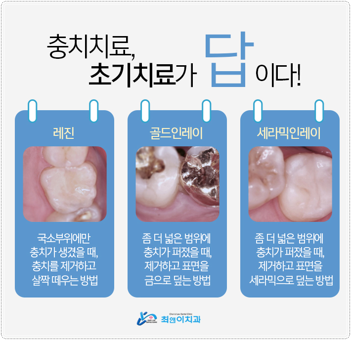 어금니깨짐 불편함이 있다면 관련 이미지 7