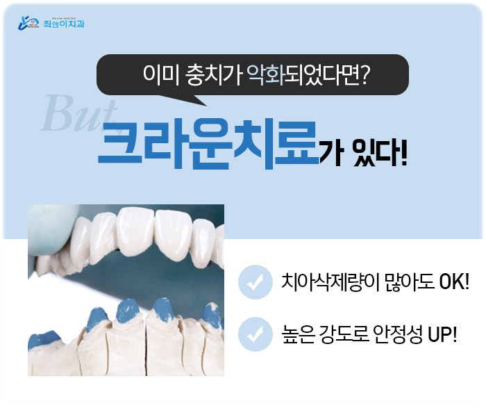 이빨깨졌을때 어쩔줄 모른다면? 관련 이미지 8