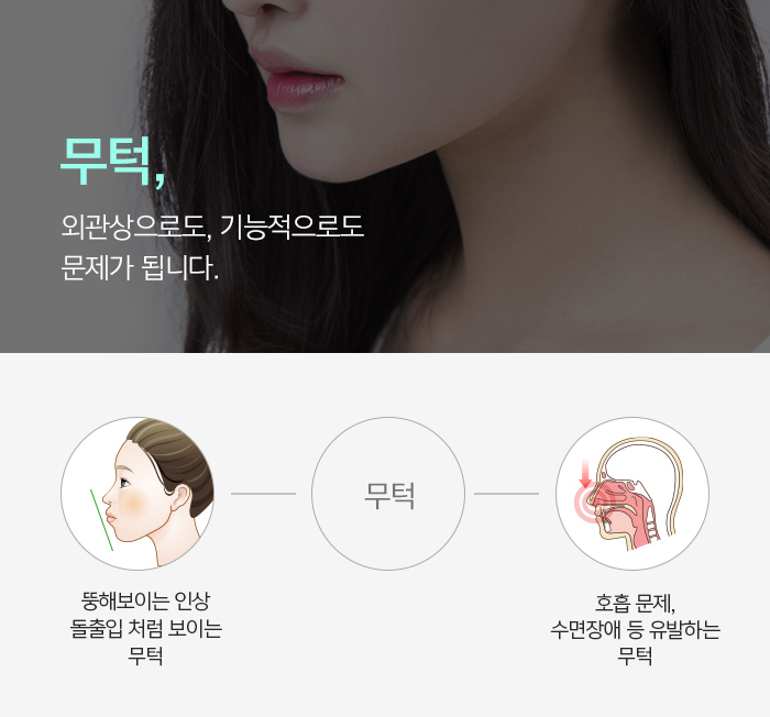 무턱 증상과 원인에 대해 관련 이미지 3