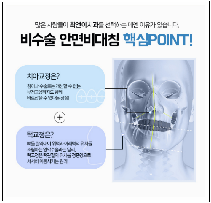 턱비대칭교정 근심이 줄어들도록 관련 이미지 8