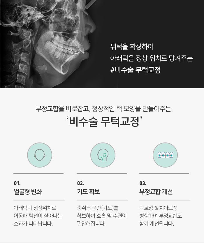 무턱 증상과 원인에 대해 관련 이미지 5