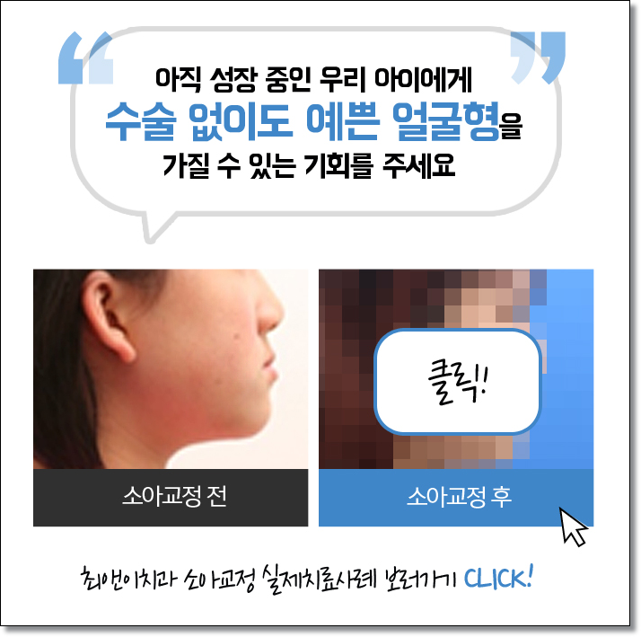 어린이주걱턱 구성부터 따져봐요 관련 이미지 4