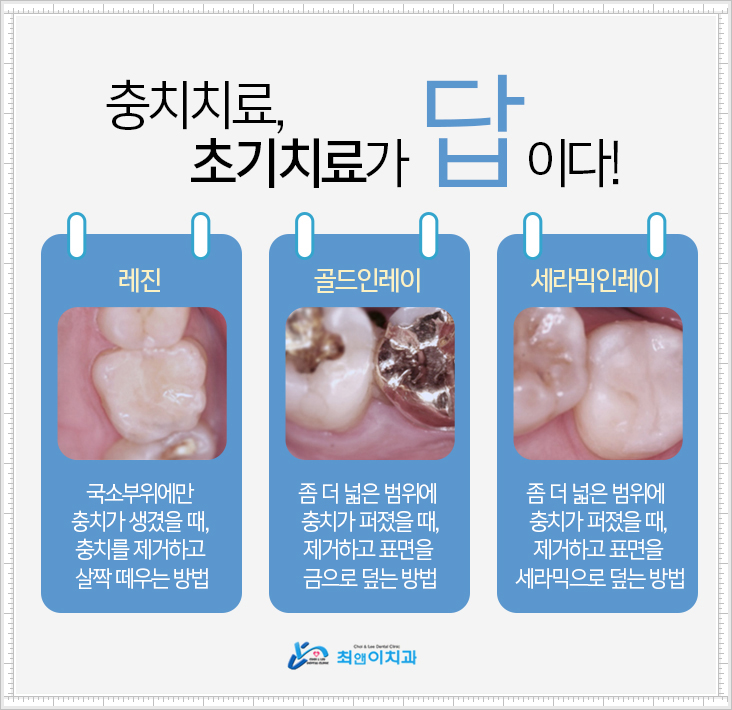 서울중구치과 왜 찾을까? 관련 이미지 8