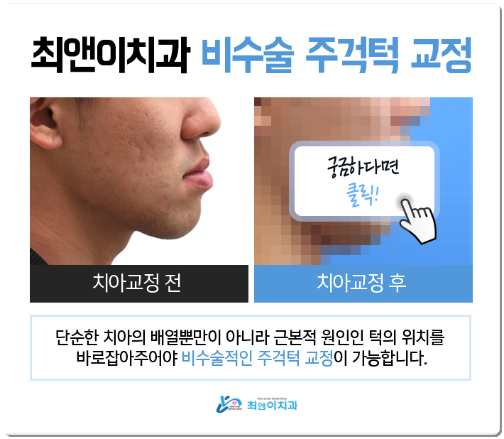 을지로치아교정 곰곰이 생각하면 관련 이미지 4
