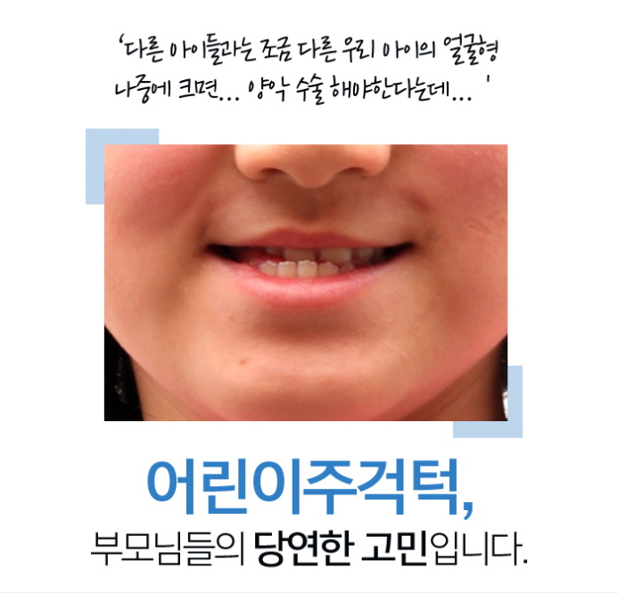 페이스마스크교정 바른 모습을 위해 관련 이미지 2