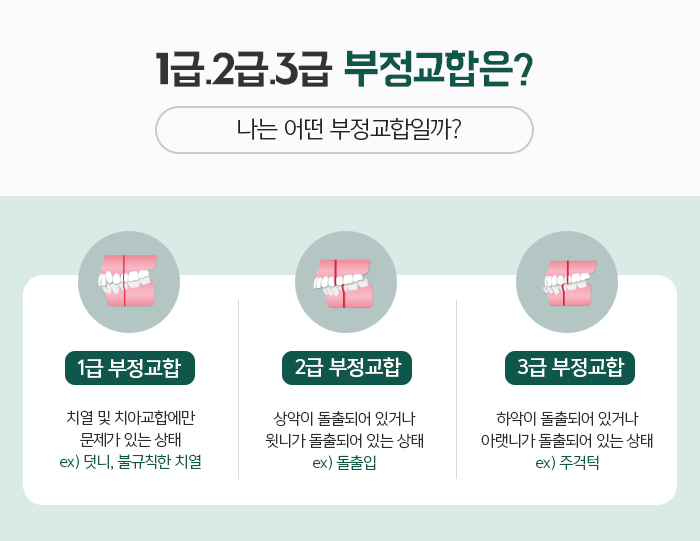 돌출입의 정의와 진단하는 방법에 대해 관련 이미지 3