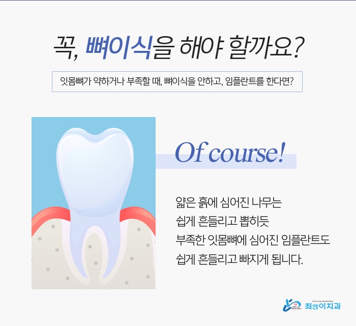 잇몸뼈이식 상태파악을 우선으로 관련 이미지 3