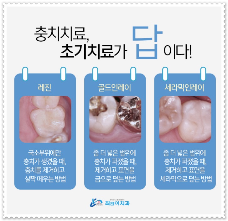깨진 앞니 방치해도 괜찮을까? 관련 이미지 6