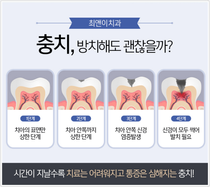 충치치료비용 상태에 적합해야죠 관련 이미지 6