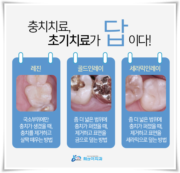 이빨부러짐 걱정은 이제 안녕 관련 이미지 7