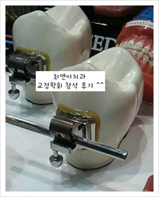 최앤이치과 치아교정과 가족들의 교정학회 참석 후기^^ 관련 이미지 6