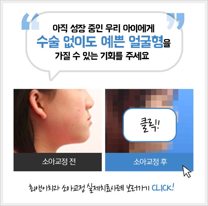 어린이주걱턱교정 이것을 확인해봐요! 관련 이미지 4