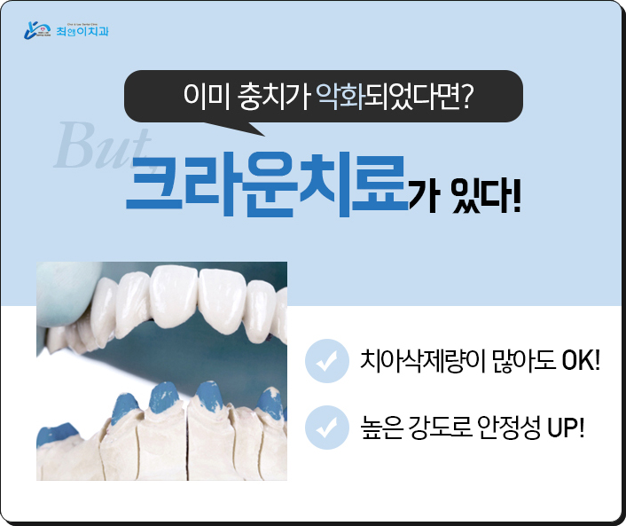 치과크라운비용 찾으시고 있다면? 관련 이미지 8