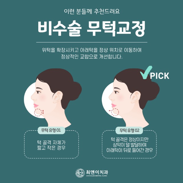 무턱 증상과 원인에 대해 관련 이미지 4