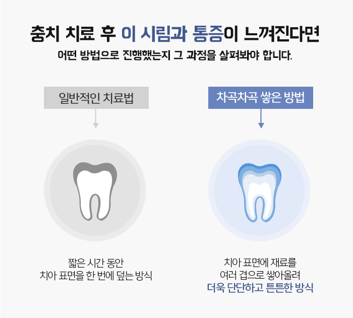 자연치아를 보존하기 위한 충치치료 방법 관련 이미지 7