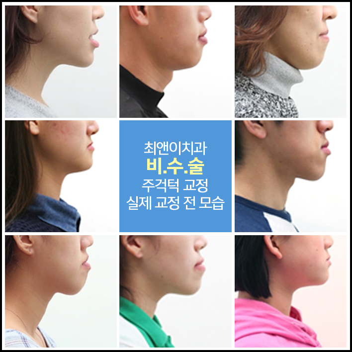 부정교합턱관절 이상 증세가 보인다면 관련 이미지 3