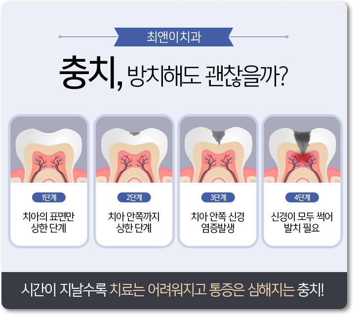 광화문역치과 간단하여도 달라야 하죠 관련 이미지 7