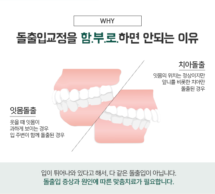 돌출입의 정의와 진단하는 방법에 대해 관련 이미지 5