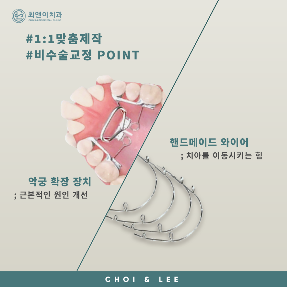 주걱턱의 정의와 증상에 대해 관련 이미지 7