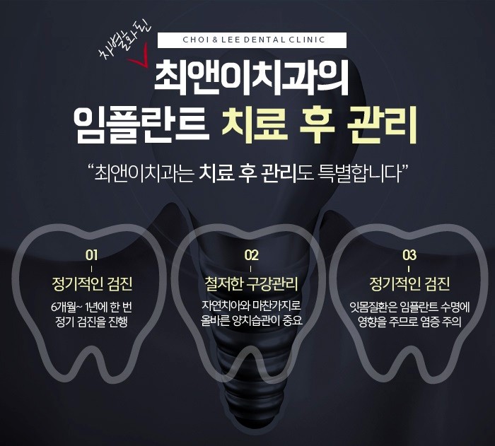 전체임플란트비용 상태에 따라서 관련 이미지 9