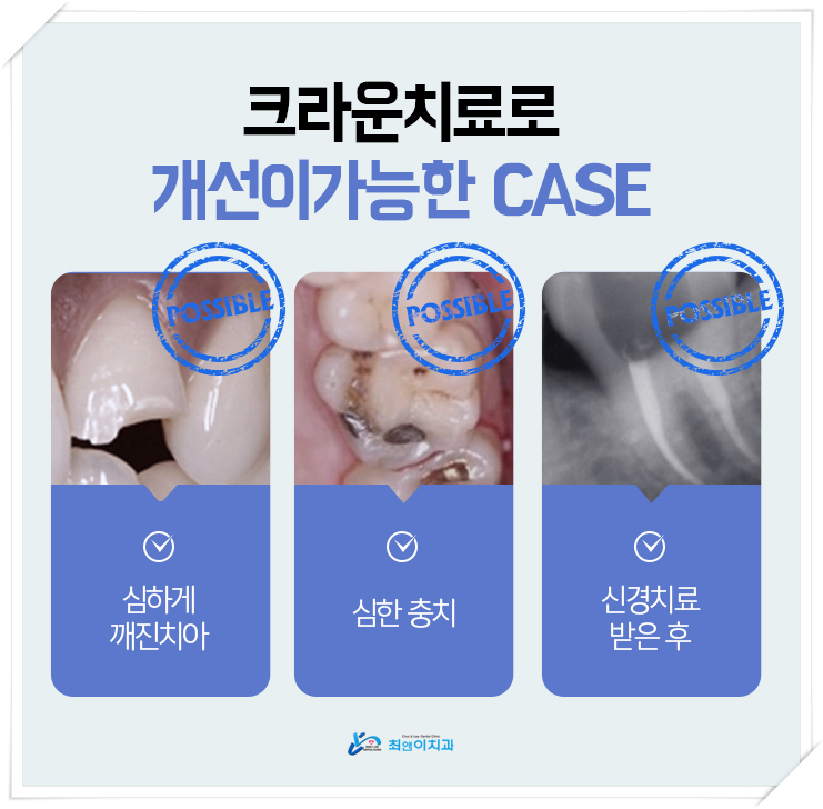 앞이빨 깨짐 허전함이 느껴지면 관련 이미지 9