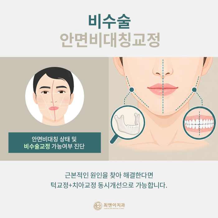 안면비대칭 증상과 원인에 대해 관련 이미지 5