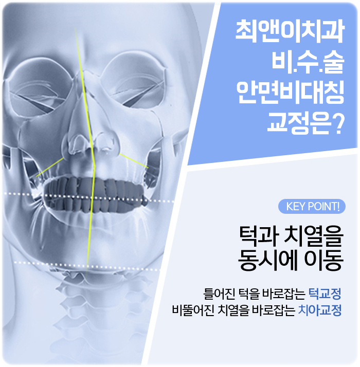 안면비대칭원인 도대체 어떻길래? 관련 이미지 7