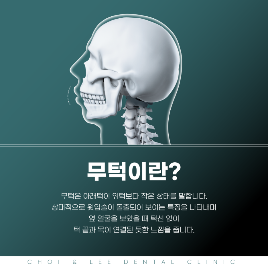 무턱 증상과 원인에 대해 관련 이미지 2