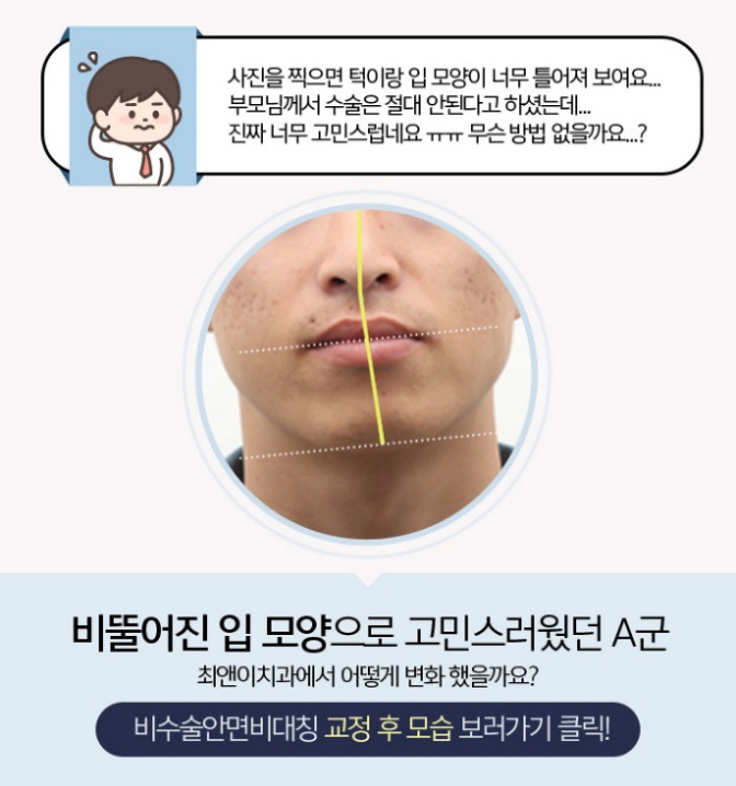 입술비대칭 원인은 무엇일까요? 관련 이미지 6