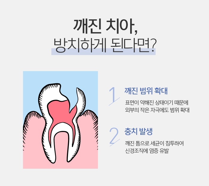 앞니브릿지잘하는곳 상황에 적합하도록 관련 이미지 2