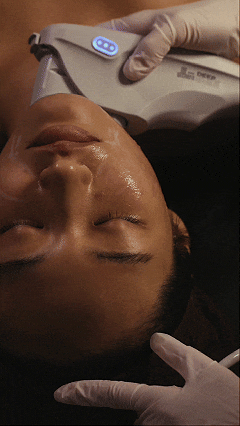 청담 울쎄라 볼패임 언제부터 느낌이? 관련 이미지 1