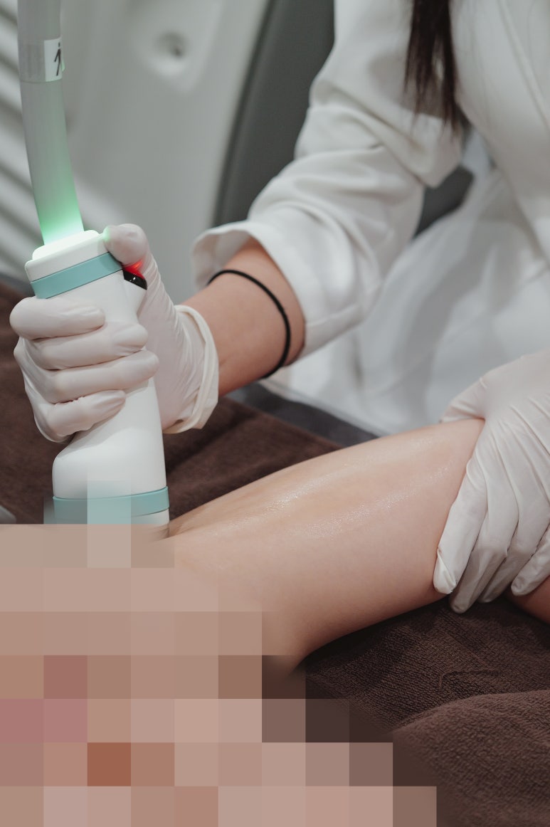 압구정로데오피부과 팔뚝살 커팅 지방분해주사와 바디 레이저 조합이 필요한 이유 관련 이미지 5