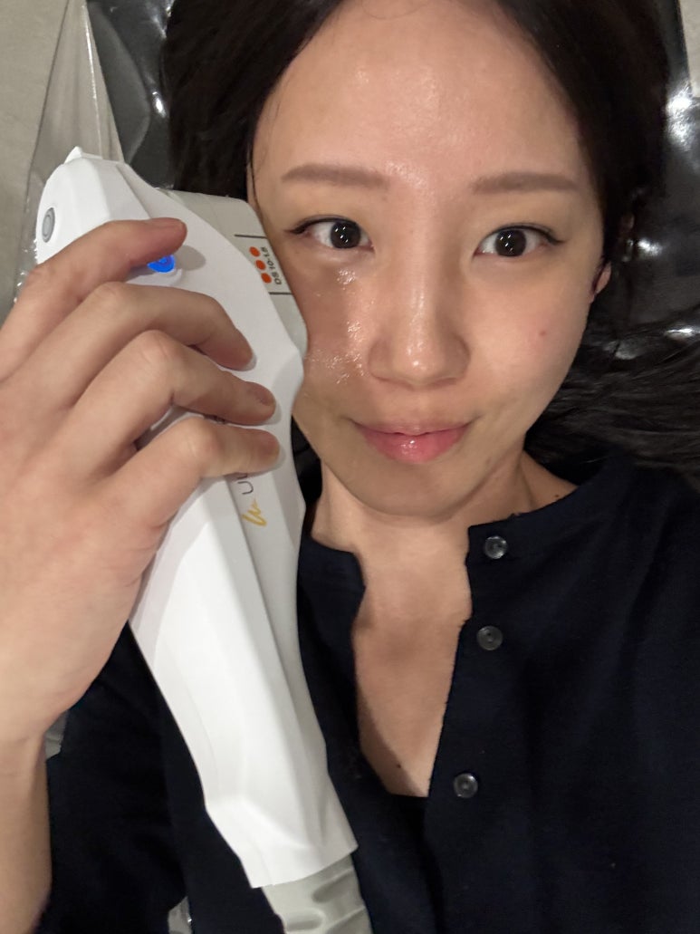 When Should You Get Treatment for Crow’s Feet in Cheongdam? image 3