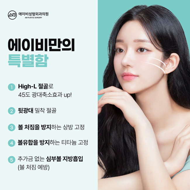 에이비성형외과 4D픽스 광대축소술 이게 뭔데? 관련 이미지 3