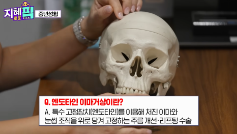 AB Plastic Surgery Appears on Jihye Pick! From Facelifts to Various Middle-Aged Cosmetic Procedures image 15