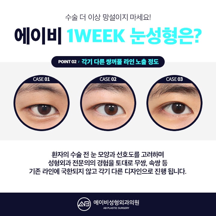 남자눈성형후기 AB성형외과는 남달라 관련 이미지 2