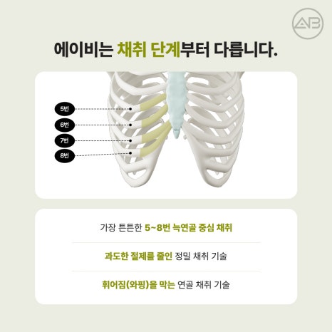 에이비성형외과 자가늑연골 비주라인 코재수술 시기와 교정 체크포인트 관련 이미지 2