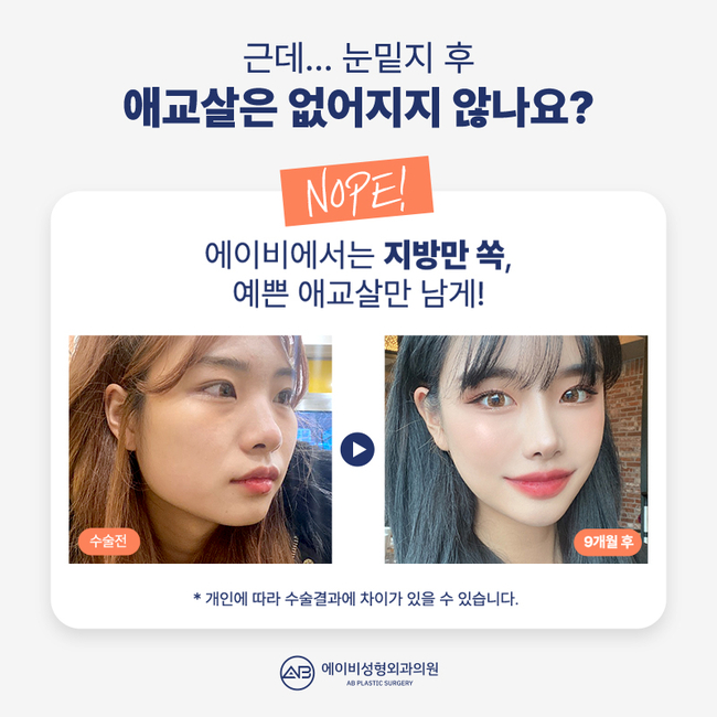 에이비 나노 눈밑지 이게 뭔데? 관련 이미지 8