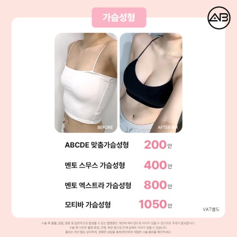 에이비성형외과 설렘 가득 봄 한정 49% 할인 이벤트 관련 이미지 11
